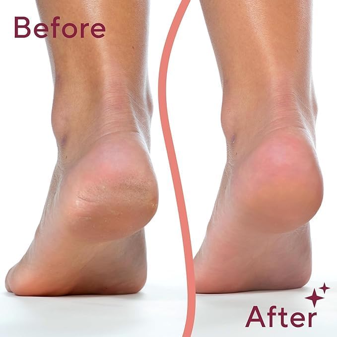 Selynne SmoothSculpt Pro