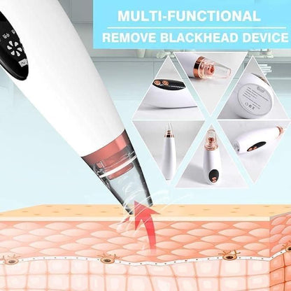 Selynne 6-in-1 Pore Refining Kit