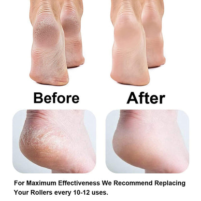 Selynne SmoothSculpt Pro